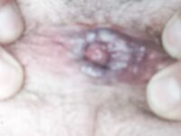 Book fotografico del mio mini uccelletto...e del culo