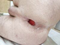 Penetrazioni Estreme!!