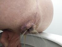 Gonfiamento Pancia Per Clistere!