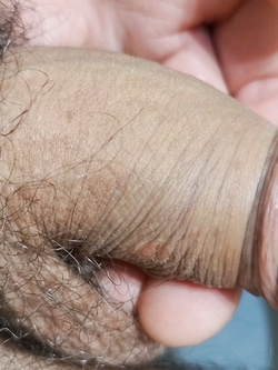Mio pene piccolo - Foto 2