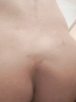 Ci siamo Total body depilazione - Foto 5