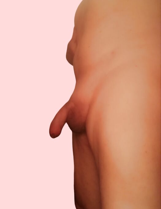 NUDISTA ED ESIBIZIONISTA